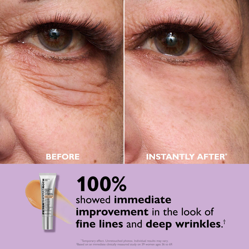 Brivex™ Eye Cream Tightener