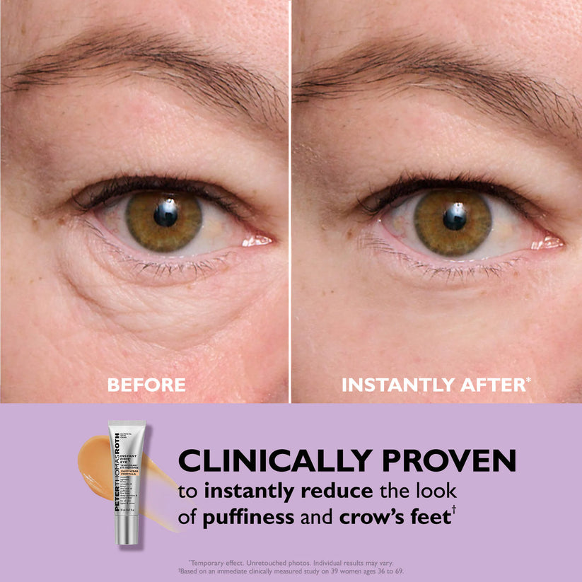 Brivex™ Eye Cream Tightener