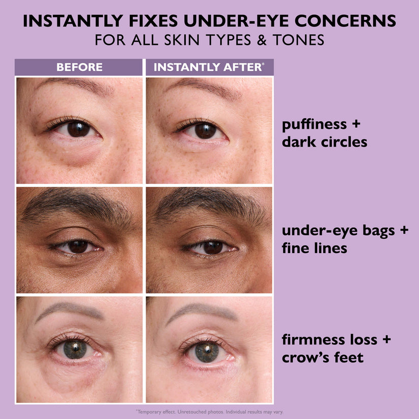 Brivex™ Eye Cream Tightener